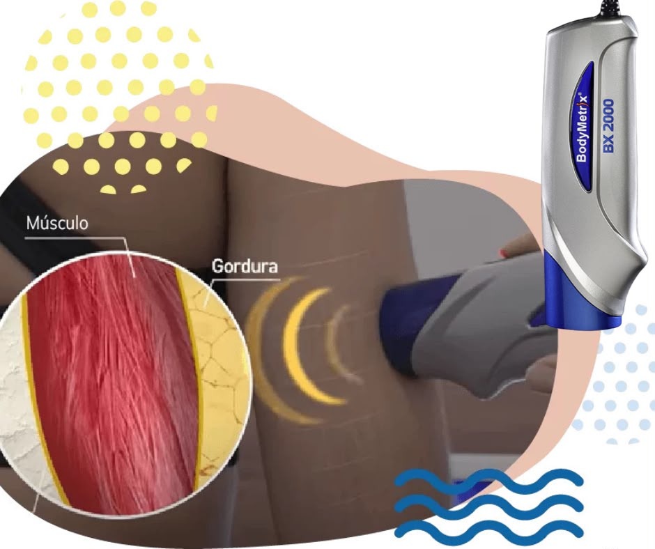 Avaliação BodyMetrix Ultrassom Piracicaba